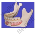 Lower Jaw Model