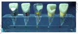 Clinical Model of Endodontics
