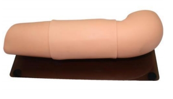 Subcutaneous Embedded Contraception Arm