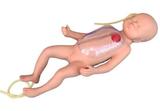 Neonatal Peripheral and Central Vein Intubation Simulator