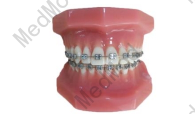 Fixed Orthodontic Model (Normal)