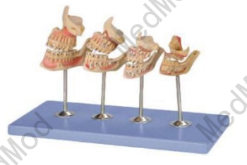 Development of a set of Teeth