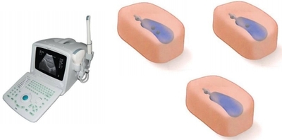 Gallbladder Ultrasound Examination Training Model