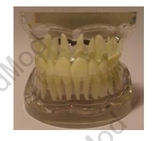 Transparent Adult Teeth Model
