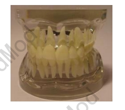 Transparent Adult Teeth Model