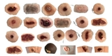 High Simulation Trauma Evaluation Modules