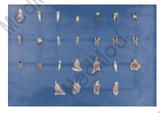 Dental Diseases Model