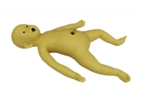 Jaundice Baby Model