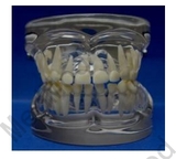 Transparent Milk Teeth Development Model