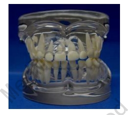 Transparent Milk Teeth Development Model