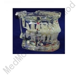 Transparent Dental Pathology Model