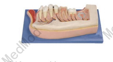 Lower Jaw of 12-year-old