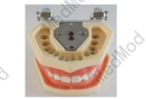 Standard Teeth Model with Nuts Fixation