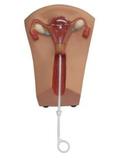 IUD Training Model