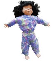 Down’s Syndrome Baby