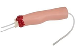 Upper Limb Trauma Amputaion and Hemostasis Model