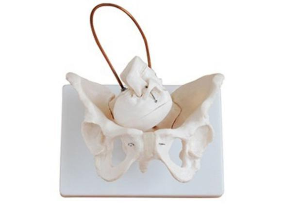 Female Pelvis with Fetal Head