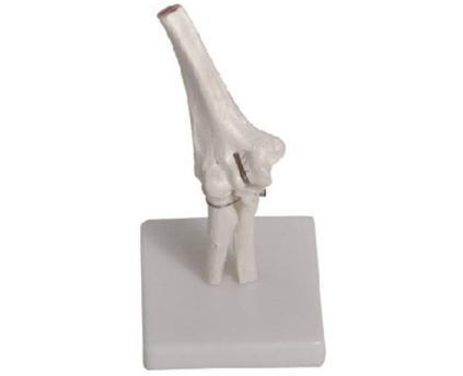 Elbow Joint