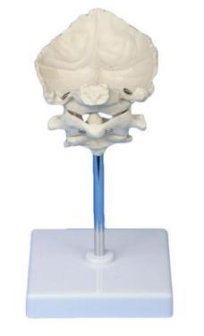 Atlas Axix with Occipital Bone Model