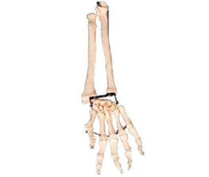 Palm Bone with Elbow Bone and Radial Bone