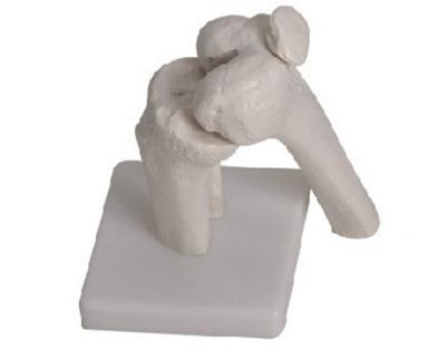 Knee Joint