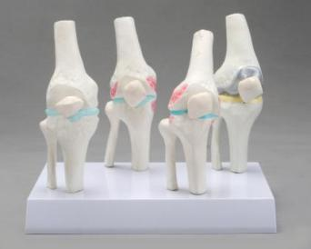 Knee Joints Synthesis Model