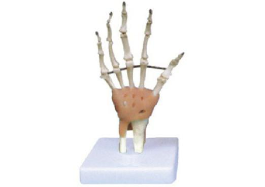 Hand Joint with Ligament