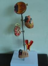 Diabetes Model