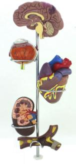 Hypertension Model