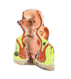 Common Diseased Rectum Model