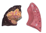 Pathological Pulmonary Model