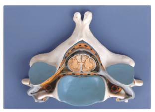 Fifth Cervical Vertebrawith Spinal Cord and Nerve