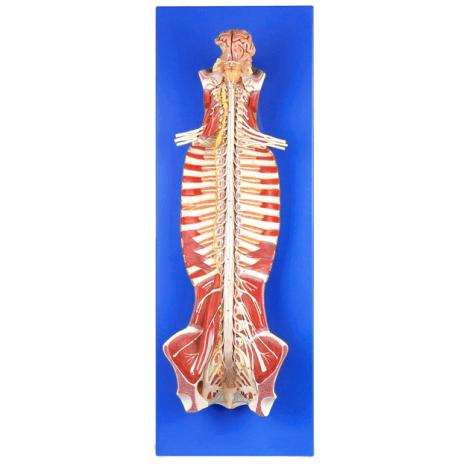 Spinal Cord In the Spinal Canal