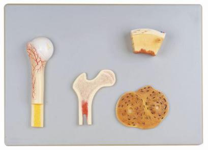 Bone Tissue Model