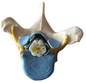 Thoracic Vertebra with Spinal Cord