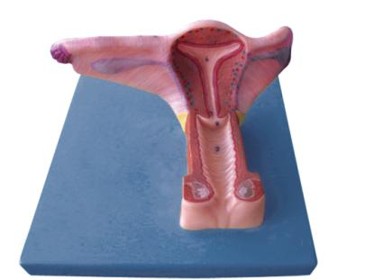 Female Inner Genital Organ