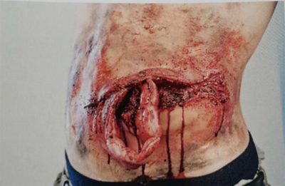 Wearable Thoracic and Abdominal Surgery Training Model